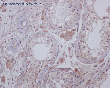 HUABIO M1506-5 image 1