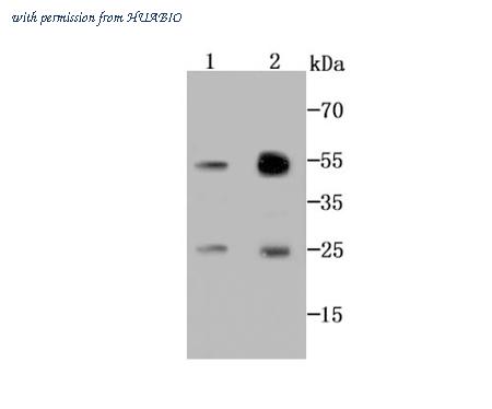 HUABIO M1509-2 image 1