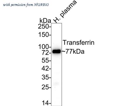 HUABIO M1510-17 image 1