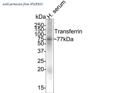 HUABIO M1510-17 image 2