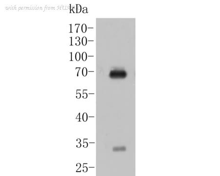 HUABIO M1510-31 image 1