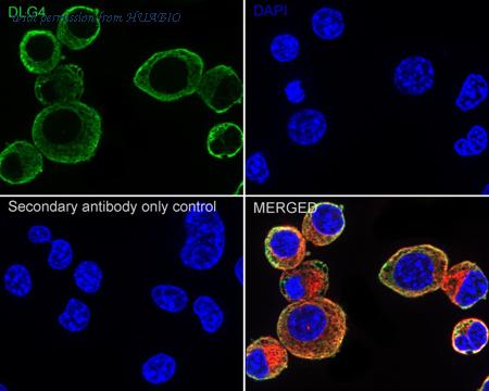 HUABIO M1511-4 image 2