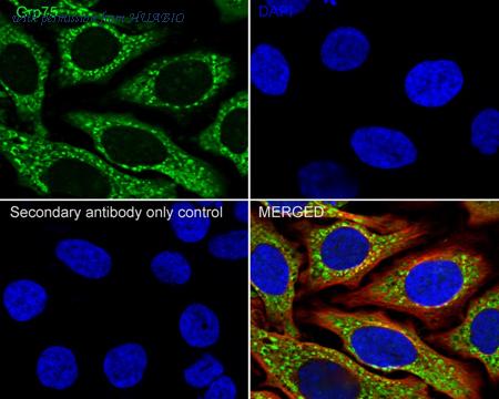 HUABIO M1603-1 image 2