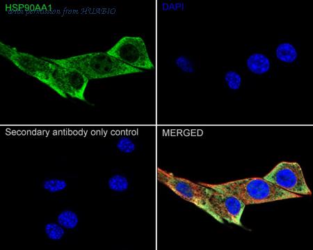 HUABIO M1603-3 image 3