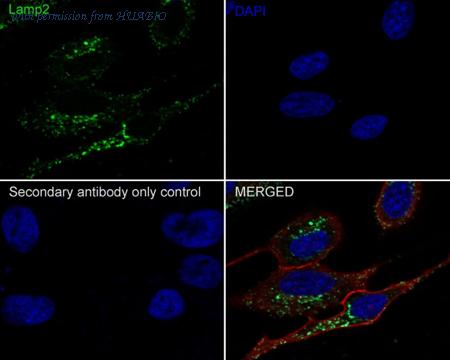 HUABIO M1603-5 image 2