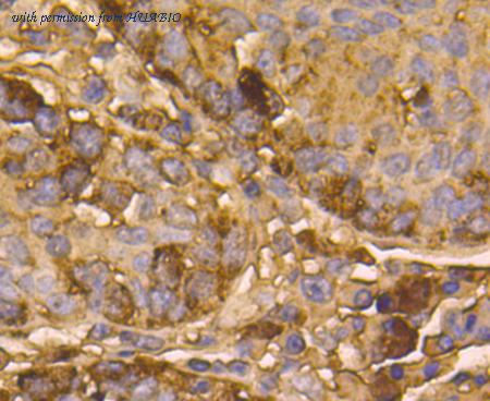 HUABIO M1701-2 image 3