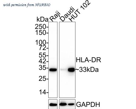 HUABIO M1701-5 image 1