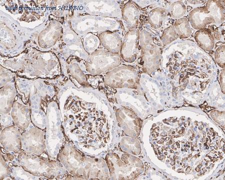 HUABIO M1701-5 image 2