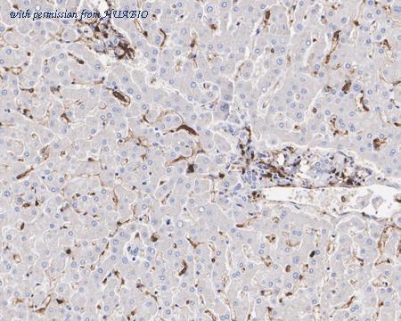 HUABIO M1701-5 image 3