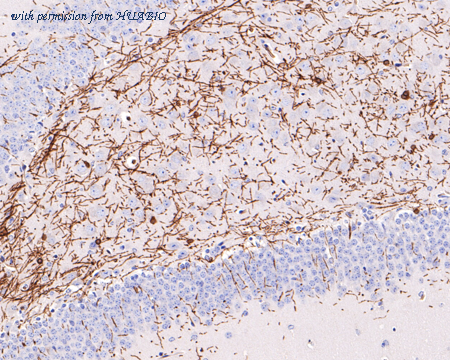 HUABIO M1701-6-50UL image 2