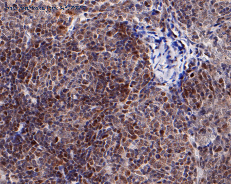 HUABIO R1107-1 image 2