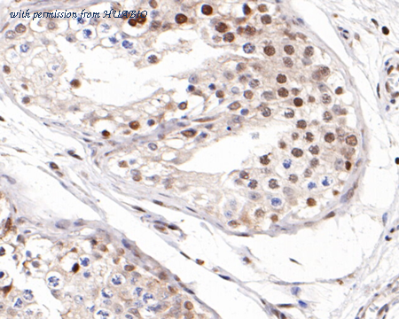 HUABIO R1107-1 image 3