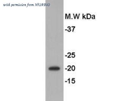 HUABIO R1204-2 image 1