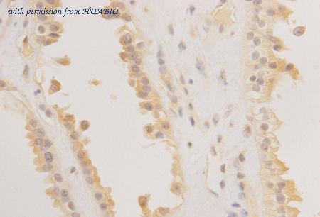 HUABIO R1204-5 image 3