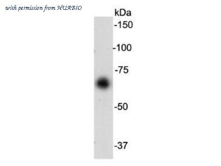 HUABIO R1212-2 image 1