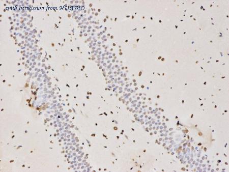 HUABIO R1308-2 image 2