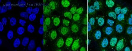 HUABIO R1310-3 image 2