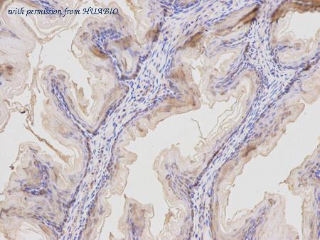 HUABIO R1311-6 image 2