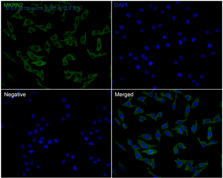 HUABIO R1312-14 image 2