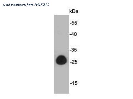 HUABIO R1312-2 image 1