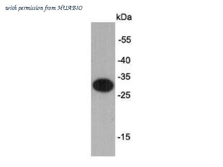 HUABIO R1401-18 image 1