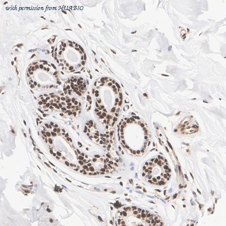 HUABIO R1401-5 image 2