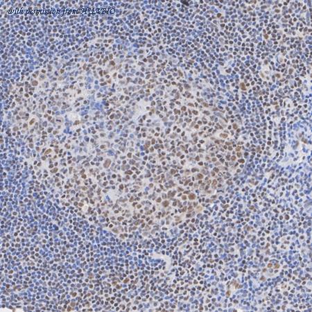 HUABIO R1401-5 image 3