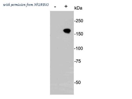 HUABIO R1403-1 image 1