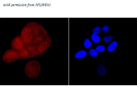 HUABIO R1403-3 image 3