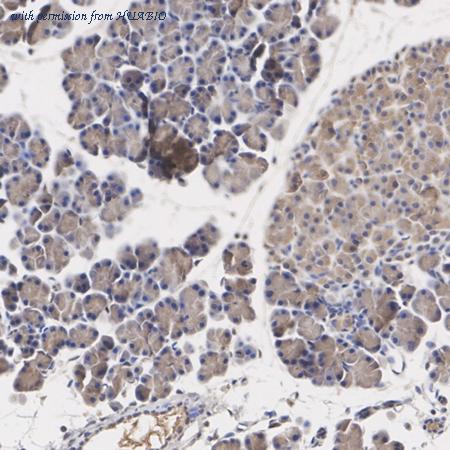 HUABIO R1404-1 image 2