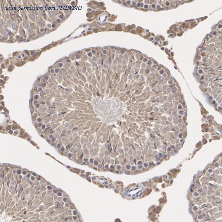 HUABIO R1404-1 image 3