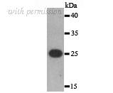 HUABIO R1406-3 image 2