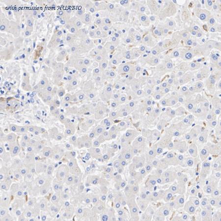 HUABIO R1406-3 image 3