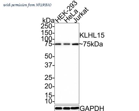 HUABIO R1407-2 image 1