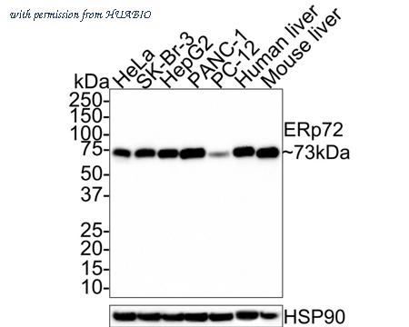 HUABIO R1409-1 image 1