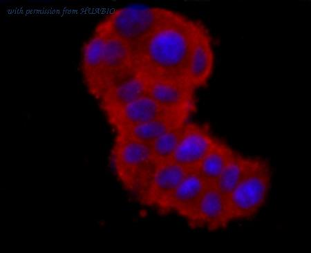 HUABIO R1409-1 image 3