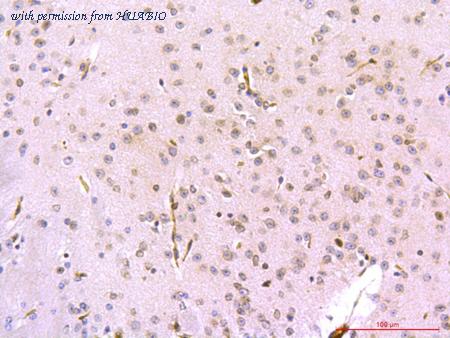 HUABIO R1508-4 image 3