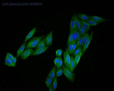 HUABIO R1510-12 image 1