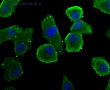 HUABIO R1510-14 image 1