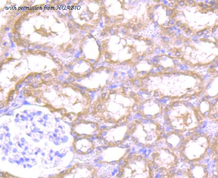 HUABIO R1510-14 image 3