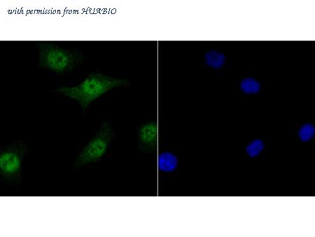 HUABIO R1510-17 image 1