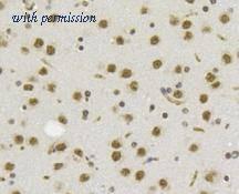 HUABIO R1510-17 image 2