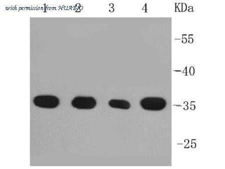 HUABIO R1510-31 image 1