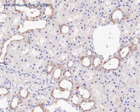 HUABIO R1510-31 image 3