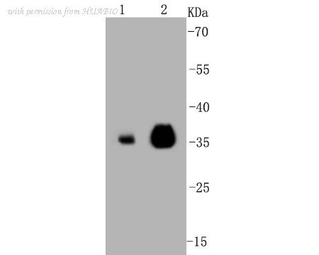 HUABIO R1510-34 image 1
