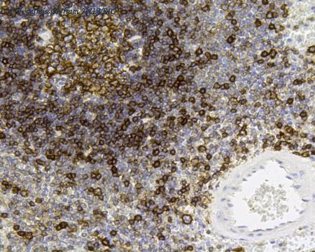 HUABIO R1510-34 image 3