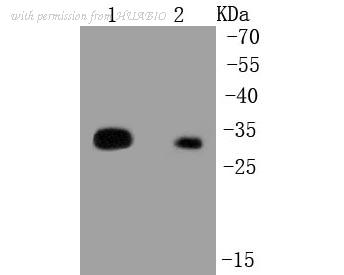 HUABIO R1510-35 image 1