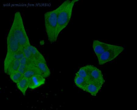 HUABIO R1510-35 image 2