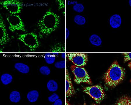 HUABIO R1510-39 image 2