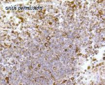 HUABIO R1510-41 image 2